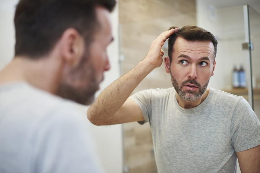 Man checking for hair loss in front of the mirror