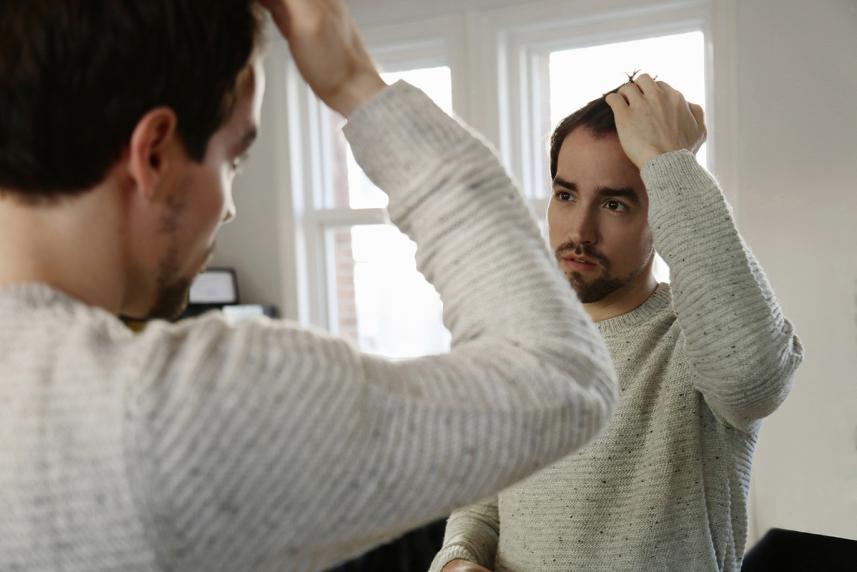 Man looking for hair loss in front of the mirror